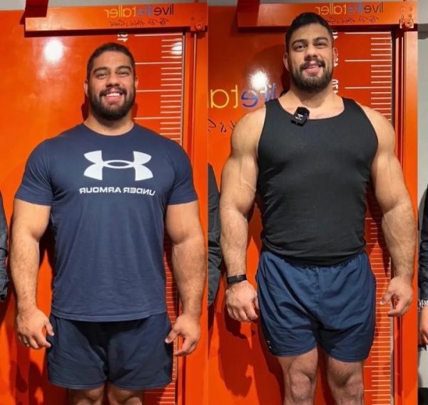 Мужчина потратил 100 тысяч евро, чтобы увеличить свой рост. «Вырос» до двух метров Мужчина потратил 100 тысяч евро, чтобы увеличить свой рост. «Вырос» до двух метров